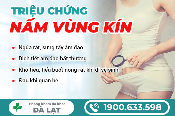 Hình ảnh minh họa